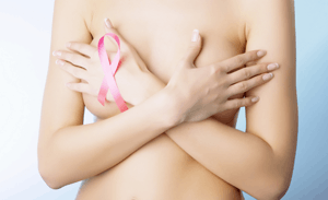 Построение плана лечения рака груди